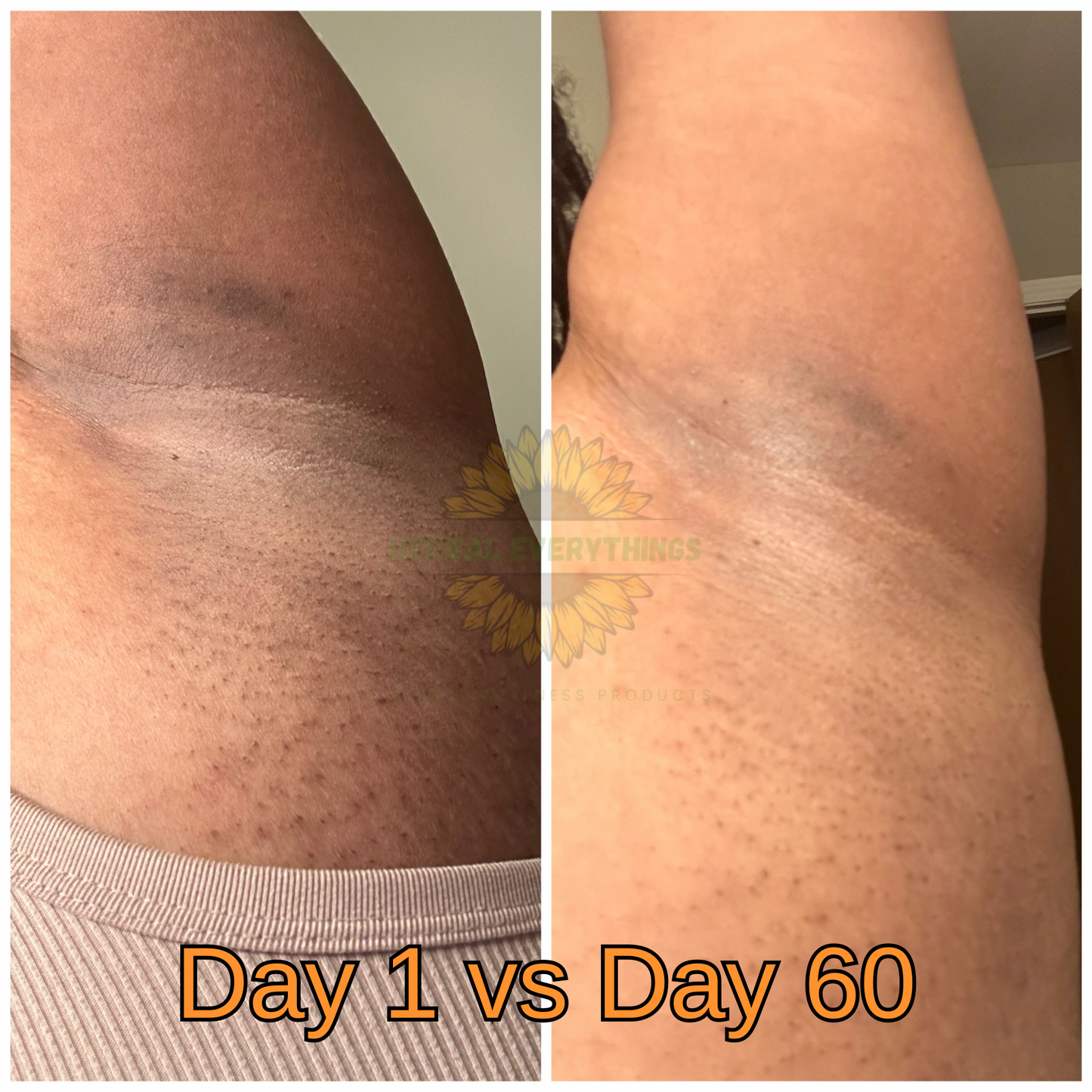 Radiance: Dark Spot Scrub