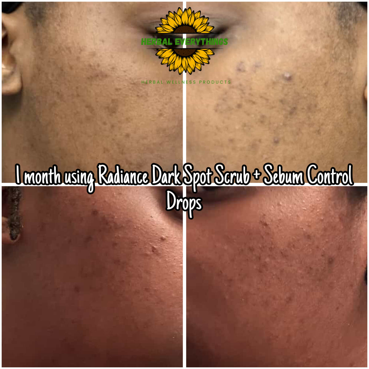 Radiance: Dark Spot Scrub
